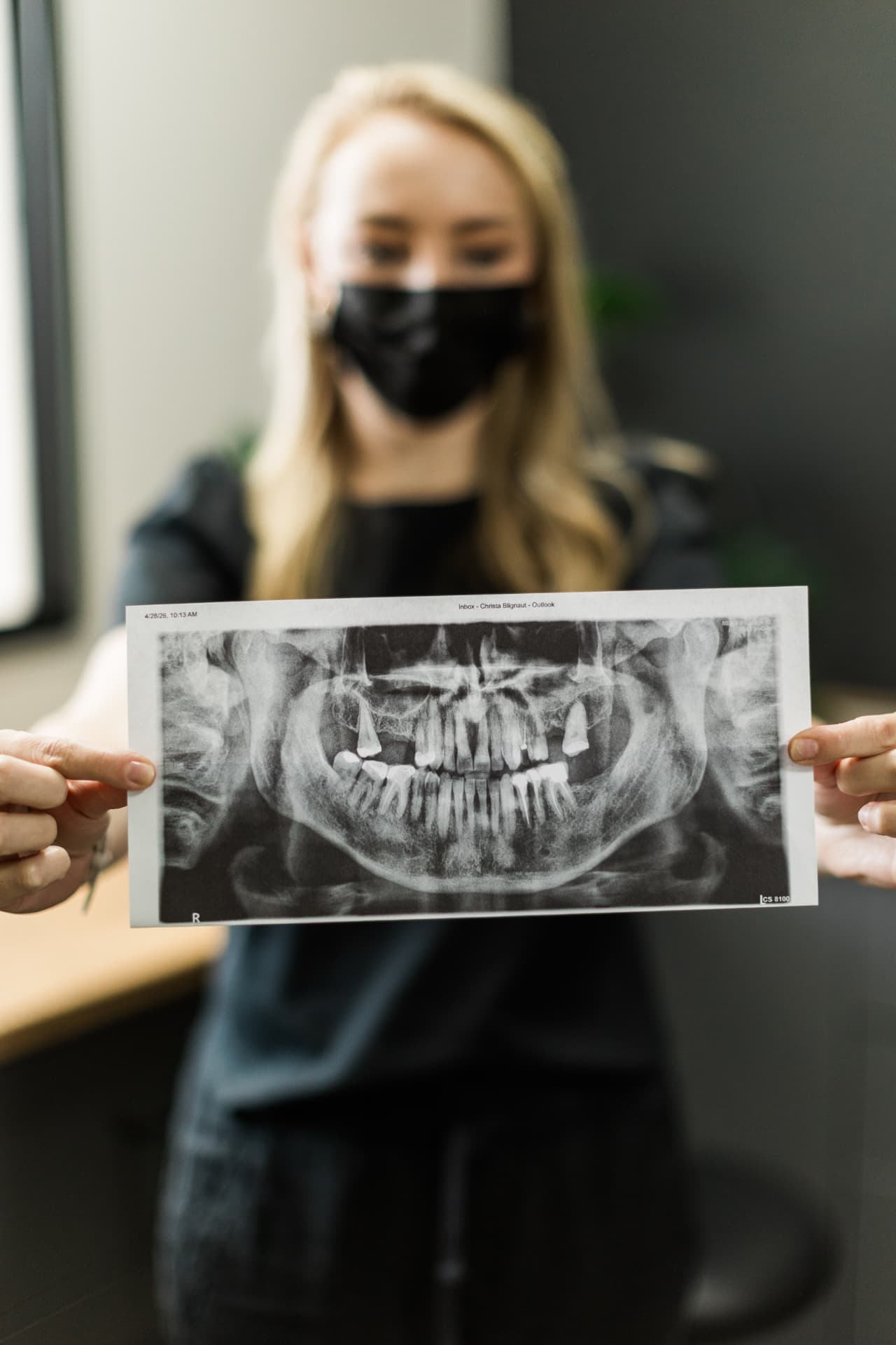 Panoramic dental radiograph used to plan periodontal and dental implant treatment